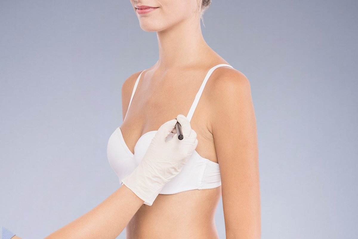 Breast Augmentation Risks