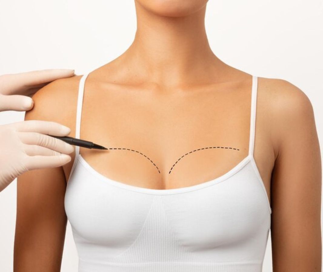 Breast Reduction Surgery in India