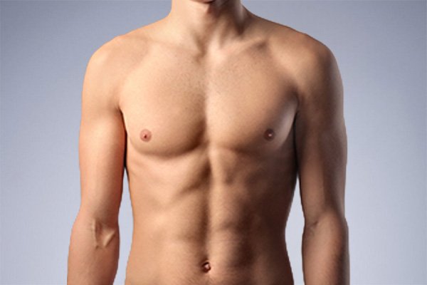 Breast Augmentation Risks