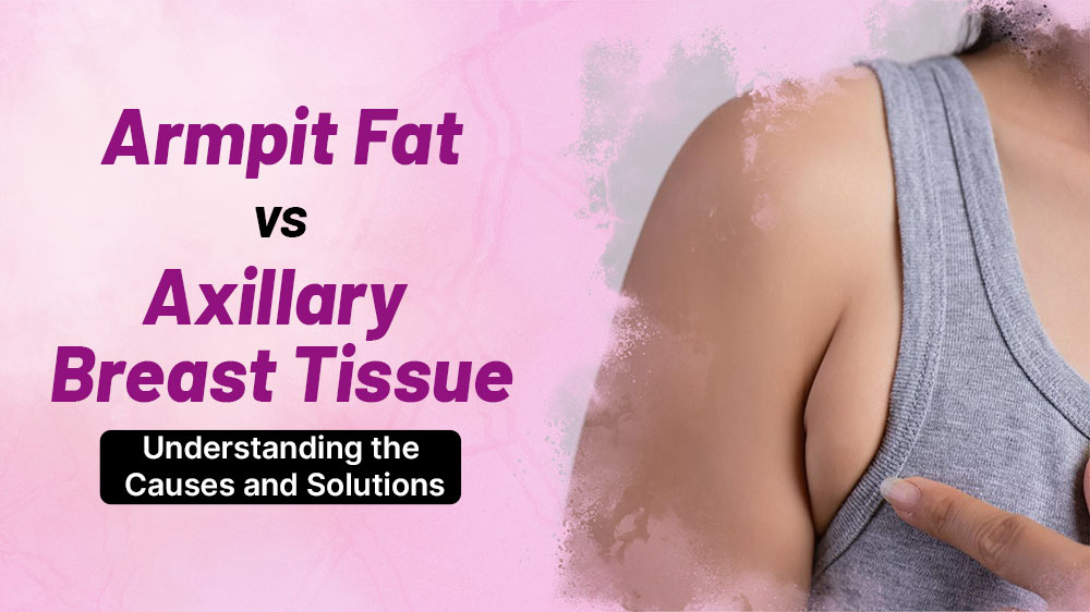 Armpit Fat vs. Axillary Breast Tissue